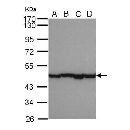 alpha smooth muscle Actin Antibody from Signalway Antibody (35513) - Antibodies.com