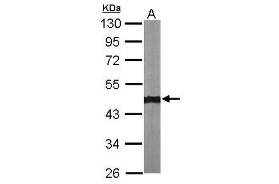 alpha smooth muscle Actin Antibody from Signalway Antibody (35513) - Antibodies.com