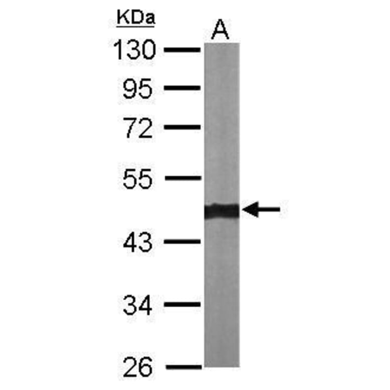 alpha smooth muscle Actin Antibody from Signalway Antibody (35513) - Antibodies.com