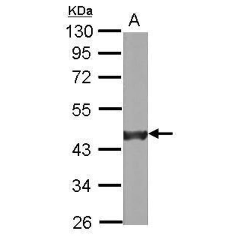 alpha smooth muscle Actin Antibody from Signalway Antibody (35513) - Antibodies.com