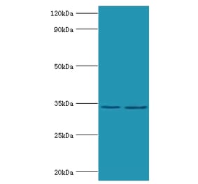 Phosphoprotein Polyclonal Antibody from Signalway Antibody (42627) - Antibodies.com