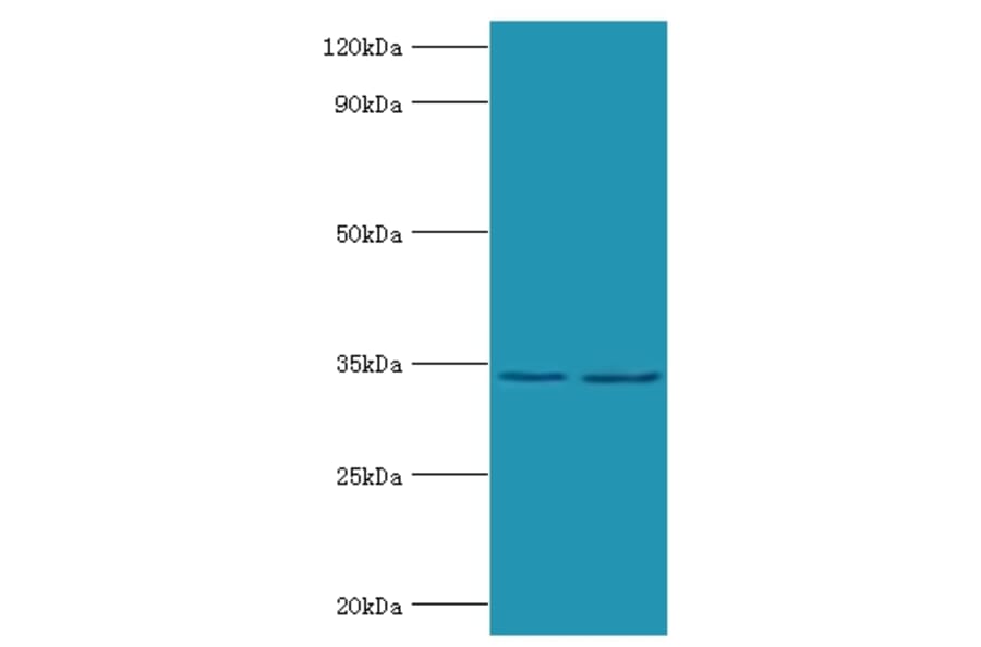 Phosphoprotein Polyclonal Antibody from Signalway Antibody (42627) - Antibodies.com