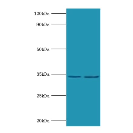 Phosphoprotein Polyclonal Antibody from Signalway Antibody (42627) - Antibodies.com