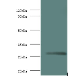 Matrix protein Polyclonal Antibody from Signalway Antibody (42629) - Antibodies.com