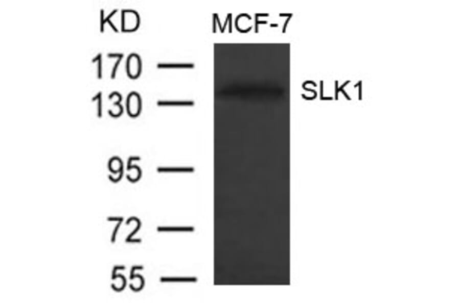 Western blot - SLK1 Antibody from Signalway Antibody (21334) - Antibodies.com