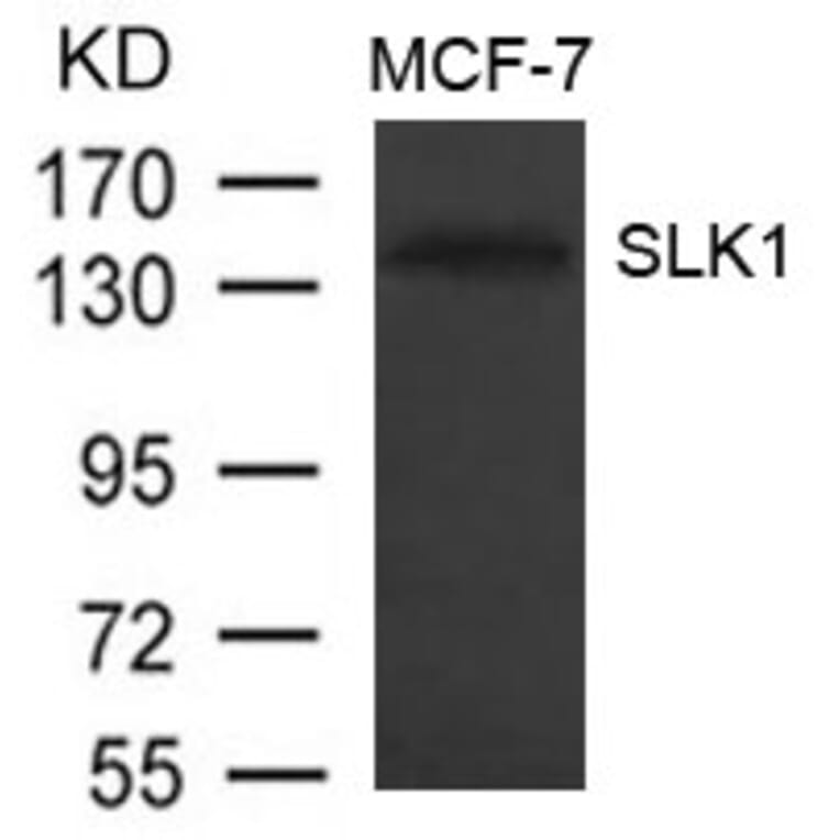 Western blot - SLK1 Antibody from Signalway Antibody (21334) - Antibodies.com