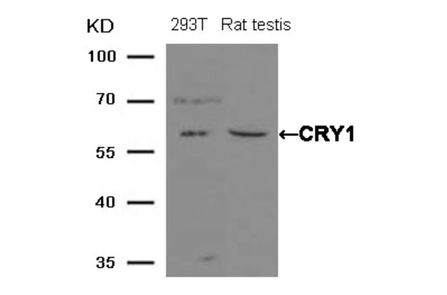 Western blot - CRY1 Antibody from Signalway Antibody (21414) - Antibodies.com