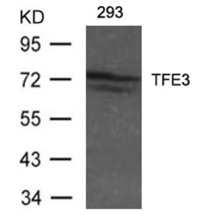 Western blot - TFE3 Antibody from Signalway Antibody (21431) - Antibodies.com
