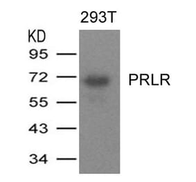 Western blot - PRLR Antibody from Signalway Antibody (21457) - Antibodies.com