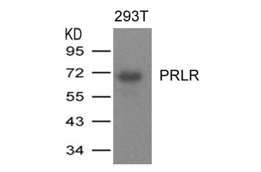 Western blot - PRLR Antibody from Signalway Antibody (21457) - Antibodies.com