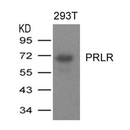 Western blot - PRLR Antibody from Signalway Antibody (21457) - Antibodies.com