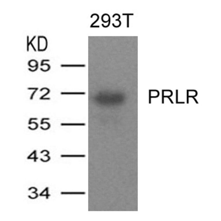 Western blot - PRLR Antibody from Signalway Antibody (21457) - Antibodies.com