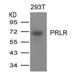 Western blot - PRLR Antibody from Signalway Antibody (21457) - Antibodies.com