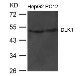 Western blot - DLK1 Antibody from Signalway Antibody (21483) - Antibodies.com