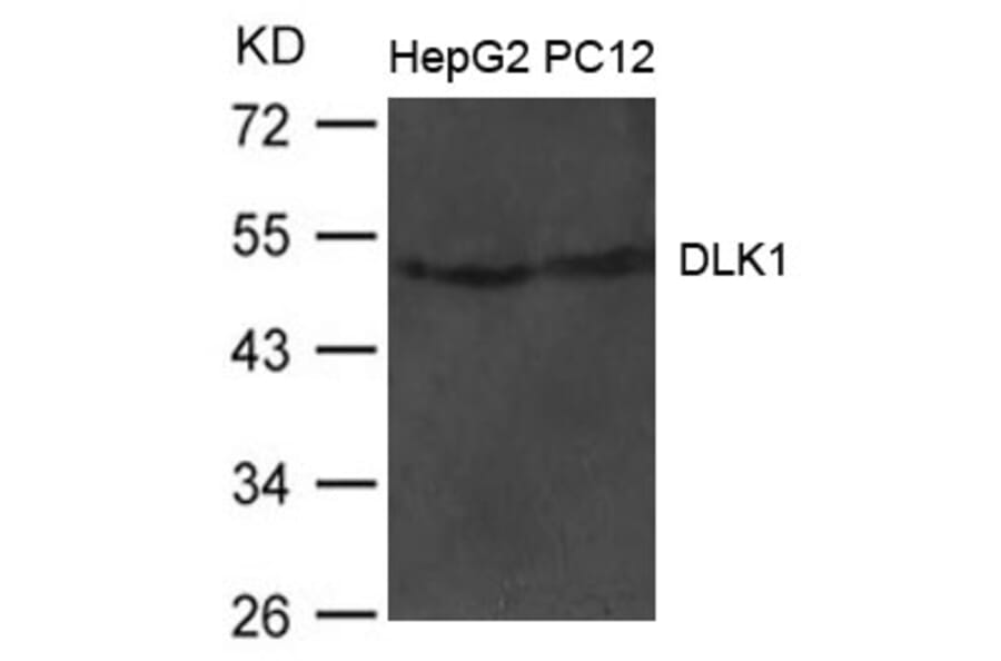 Western blot - DLK1 Antibody from Signalway Antibody (21483) - Antibodies.com