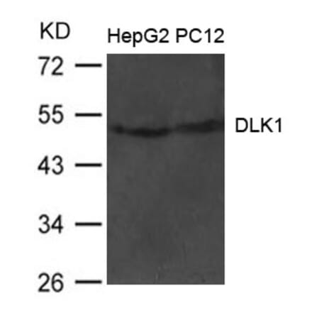 Western blot - DLK1 Antibody from Signalway Antibody (21483) - Antibodies.com