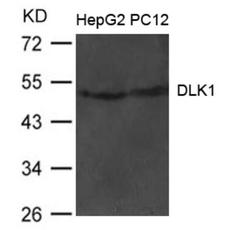 Western blot - DLK1 Antibody from Signalway Antibody (21483) - Antibodies.com