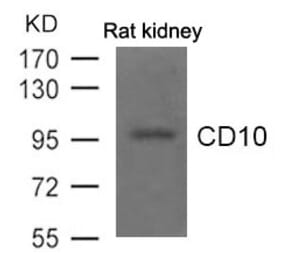 Western blot - CD10 Antibody from Signalway Antibody (21490) - Antibodies.com