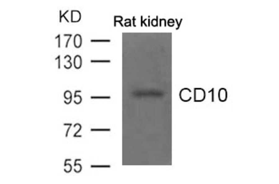 Western blot - CD10 Antibody from Signalway Antibody (21490) - Antibodies.com