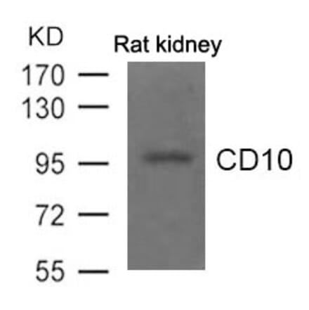 Western blot - CD10 Antibody from Signalway Antibody (21490) - Antibodies.com