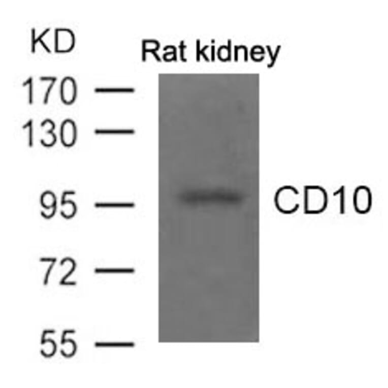Western blot - CD10 Antibody from Signalway Antibody (21490) - Antibodies.com