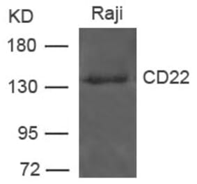 Western blot - CD22 Antibody from Signalway Antibody (21492) - Antibodies.com