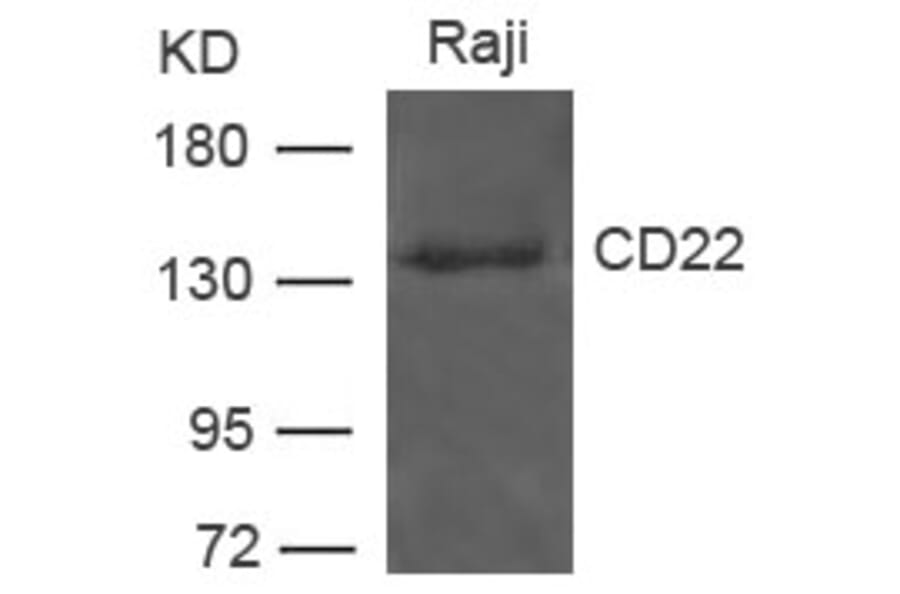 Western blot - CD22 Antibody from Signalway Antibody (21492) - Antibodies.com