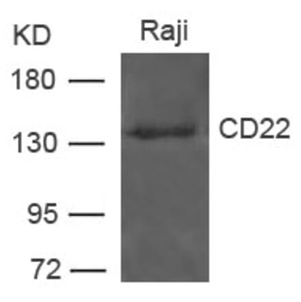 Western blot - CD22 Antibody from Signalway Antibody (21492) - Antibodies.com