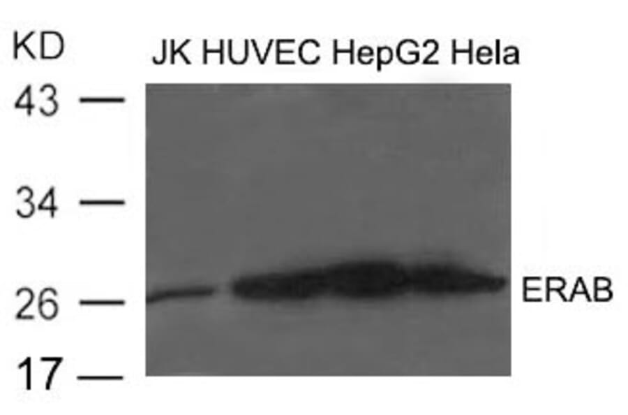 Western blot - ERAB Antibody from Signalway Antibody (21602) - Antibodies.com