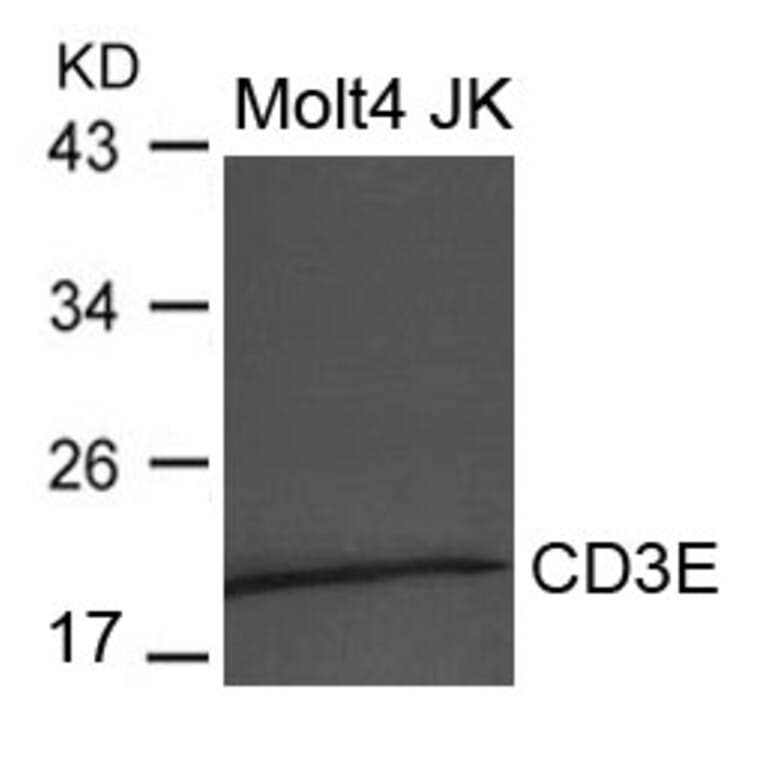 Western blot - CD3E Antibody from Signalway Antibody (21622) - Antibodies.com