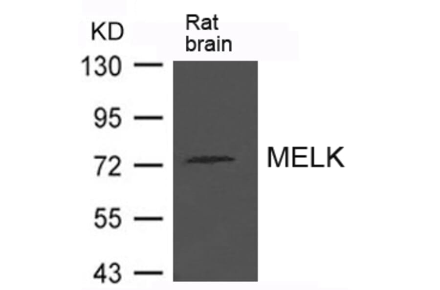 Western blot - MELK Antibody from Signalway Antibody (21625) - Antibodies.com
