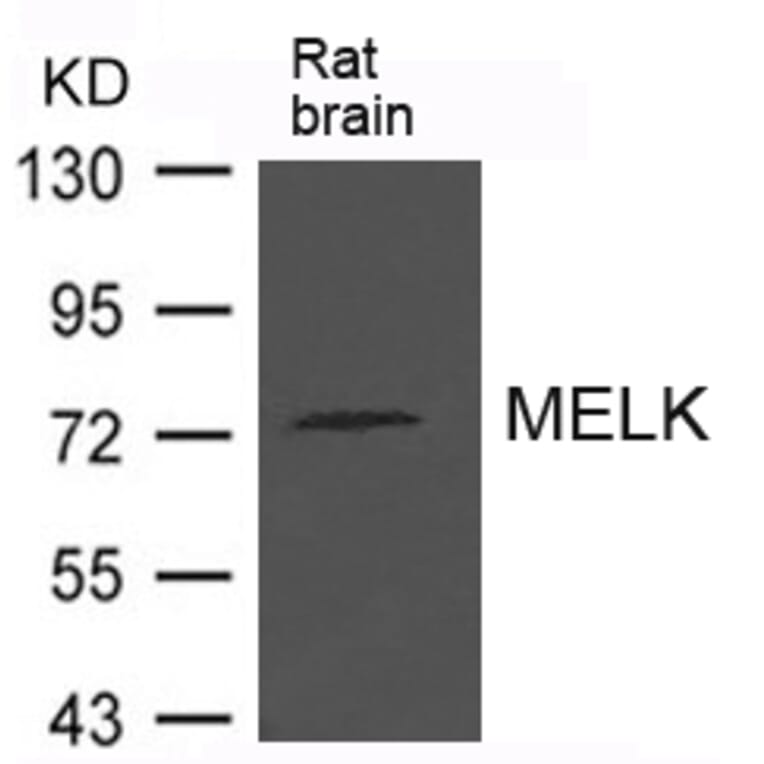 Western blot - MELK Antibody from Signalway Antibody (21625) - Antibodies.com