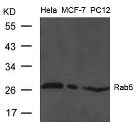 Western blot - Rab5 Antibody from Signalway Antibody (21628) - Antibodies.com