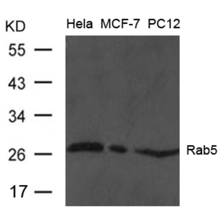 Western blot - Rab5 Antibody from Signalway Antibody (21628) - Antibodies.com