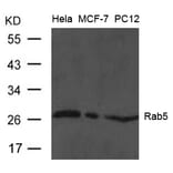 Western blot - Rab5 Antibody from Signalway Antibody (21628) - Antibodies.com