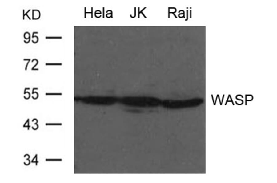Western blot - WASP Antibody from Signalway Antibody (21632) - Antibodies.com