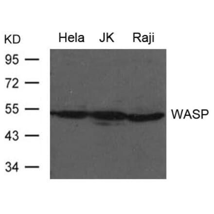 Western blot - WASP Antibody from Signalway Antibody (21632) - Antibodies.com