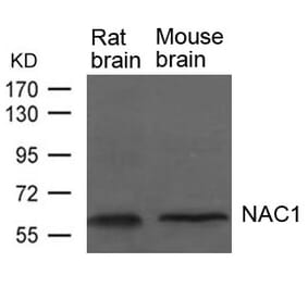 Western blot - NAC1 Antibody from Signalway Antibody (21652) - Antibodies.com