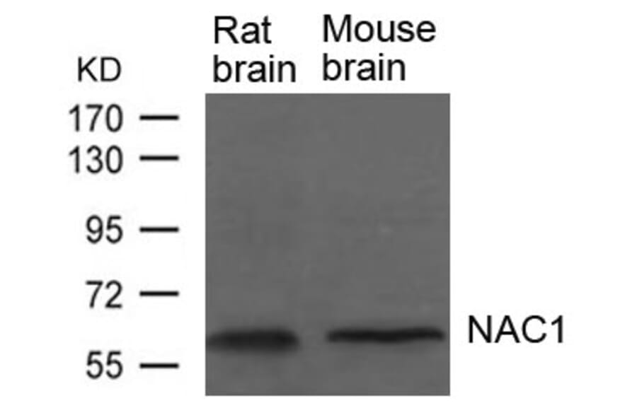 Western blot - NAC1 Antibody from Signalway Antibody (21652) - Antibodies.com