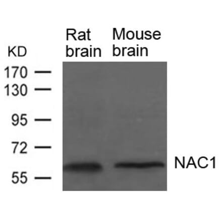 Western blot - NAC1 Antibody from Signalway Antibody (21652) - Antibodies.com