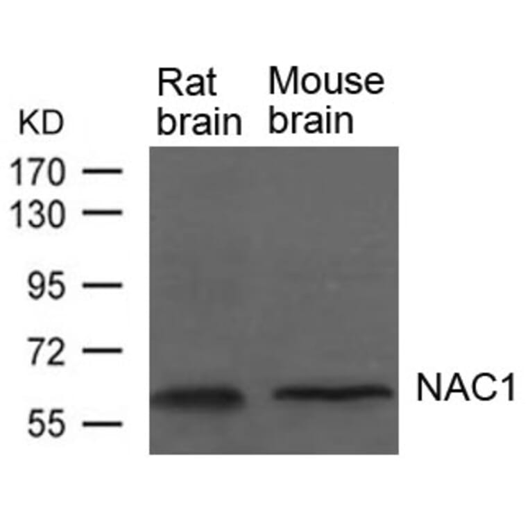 Western blot - NAC1 Antibody from Signalway Antibody (21652) - Antibodies.com