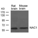 Western blot - NAC1 Antibody from Signalway Antibody (21652) - Antibodies.com