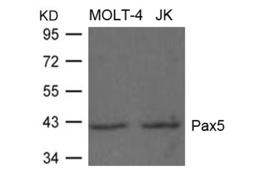 Western blot - Pax5 Antibody from Signalway Antibody (21663) - Antibodies.com