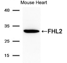 Western blot - FHL2 Antibody from Signalway Antibody (21692) - Antibodies.com