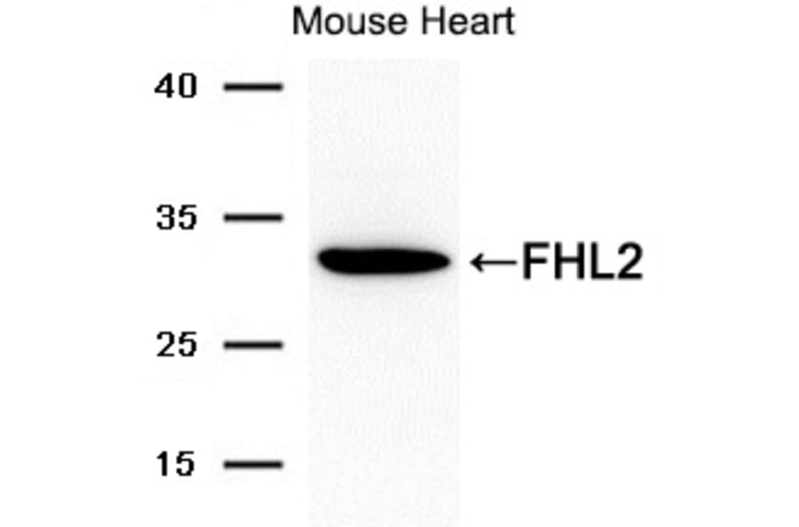 Western blot - FHL2 Antibody from Signalway Antibody (21692) - Antibodies.com