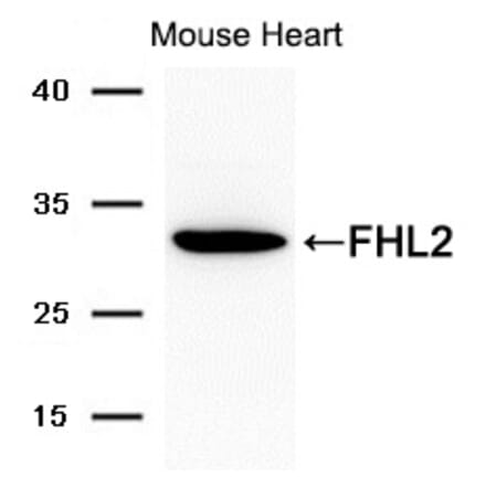 Western blot - FHL2 Antibody from Signalway Antibody (21692) - Antibodies.com