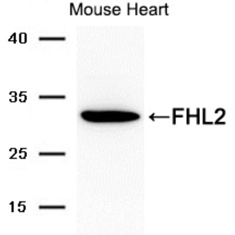 Western blot - FHL2 Antibody from Signalway Antibody (21692) - Antibodies.com