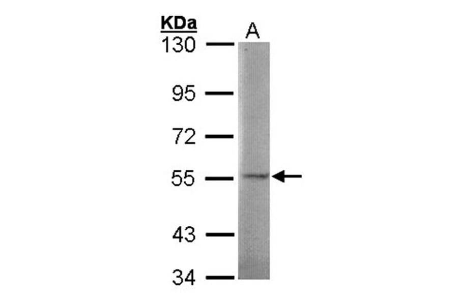 SGSH antibody from Signalway Antibody (22031) - Antibodies.com