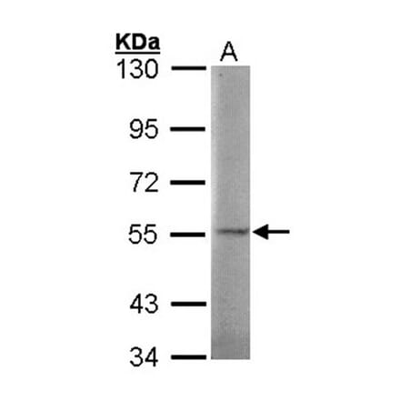 SGSH antibody from Signalway Antibody (22031) - Antibodies.com