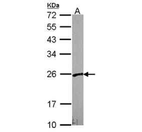 VBP1 antibody from Signalway Antibody (22061) - Antibodies.com